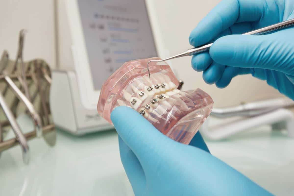 Dentures, Crowns & Bridges: Restoring Confidence with Comprehensive Dental Solutions
