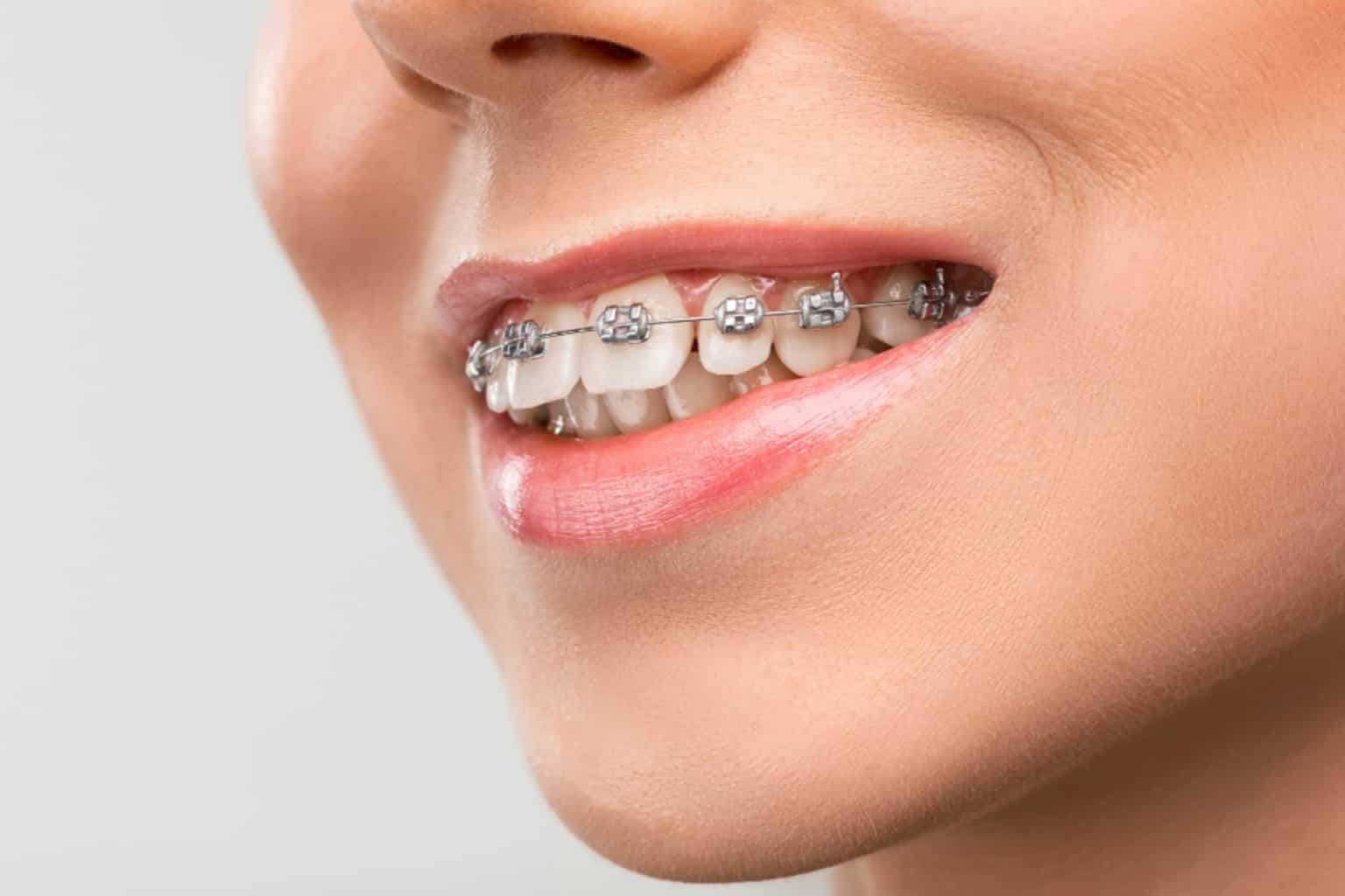 orthodontics treatment in gaur city noida extension, dentist in gaur city